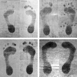 Alternative view of Voetafdruk en Neskrid gecertificeerde inlegzolen